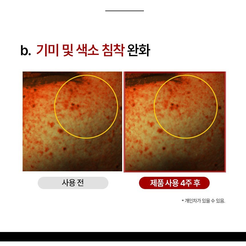 (고함량) 기미 억제 빅토나인 기미크림 트라넥삼산 대용량 잡티미백 색소침착크림, 1개, 100g할인 상세 이미지 2