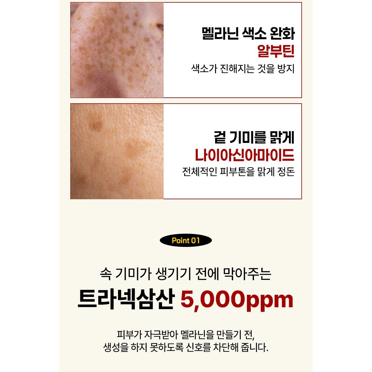 (고함량) 기미 억제 빅토나인 기미크림 트라넥삼산 대용량 잡티미백 색소침착크림, 1개, 100g할인 상세 이미지 1